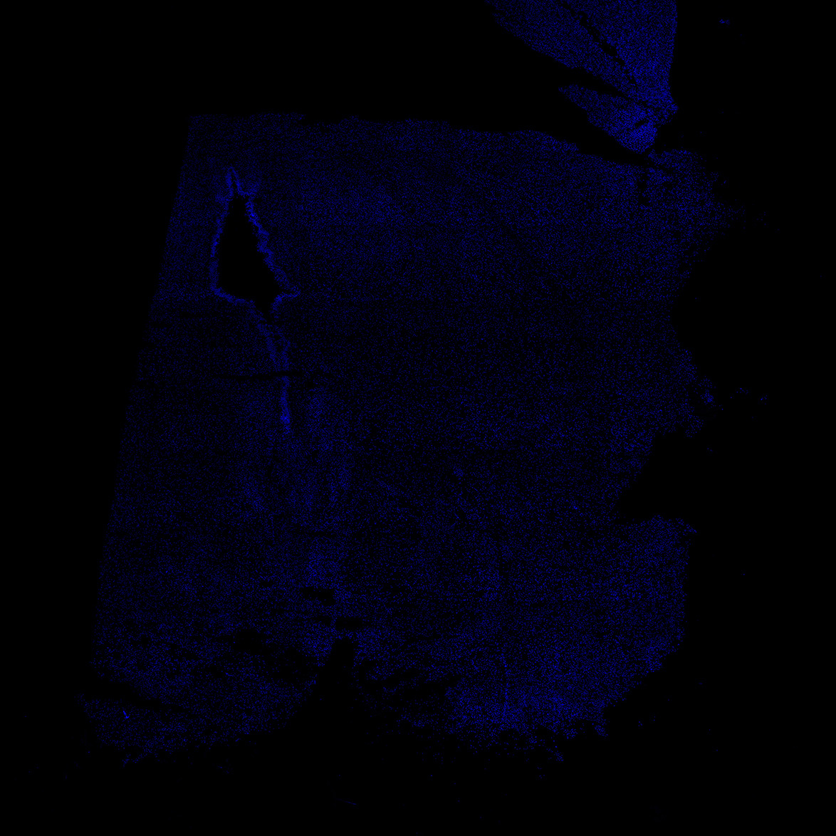 Human foetal midbrain